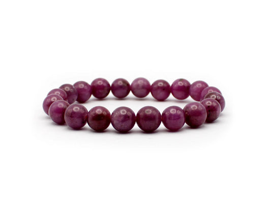 Rubin Armband 19cm lang